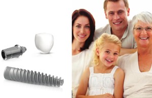 Family photo with implant graphic