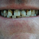 Before treatment smile case study